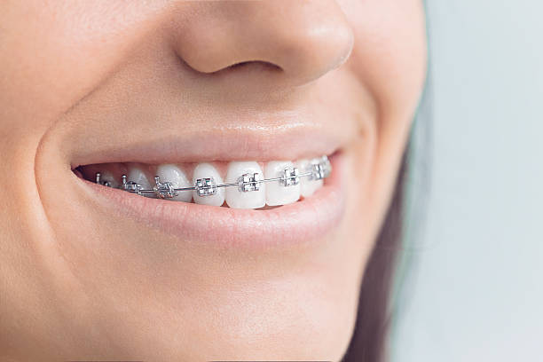 Best Full Mouth Reconstruction  in Warner, OK